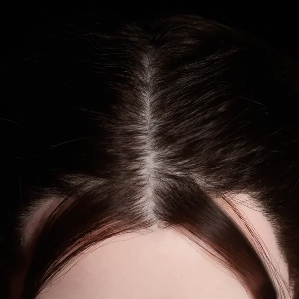 Implanted head hair
